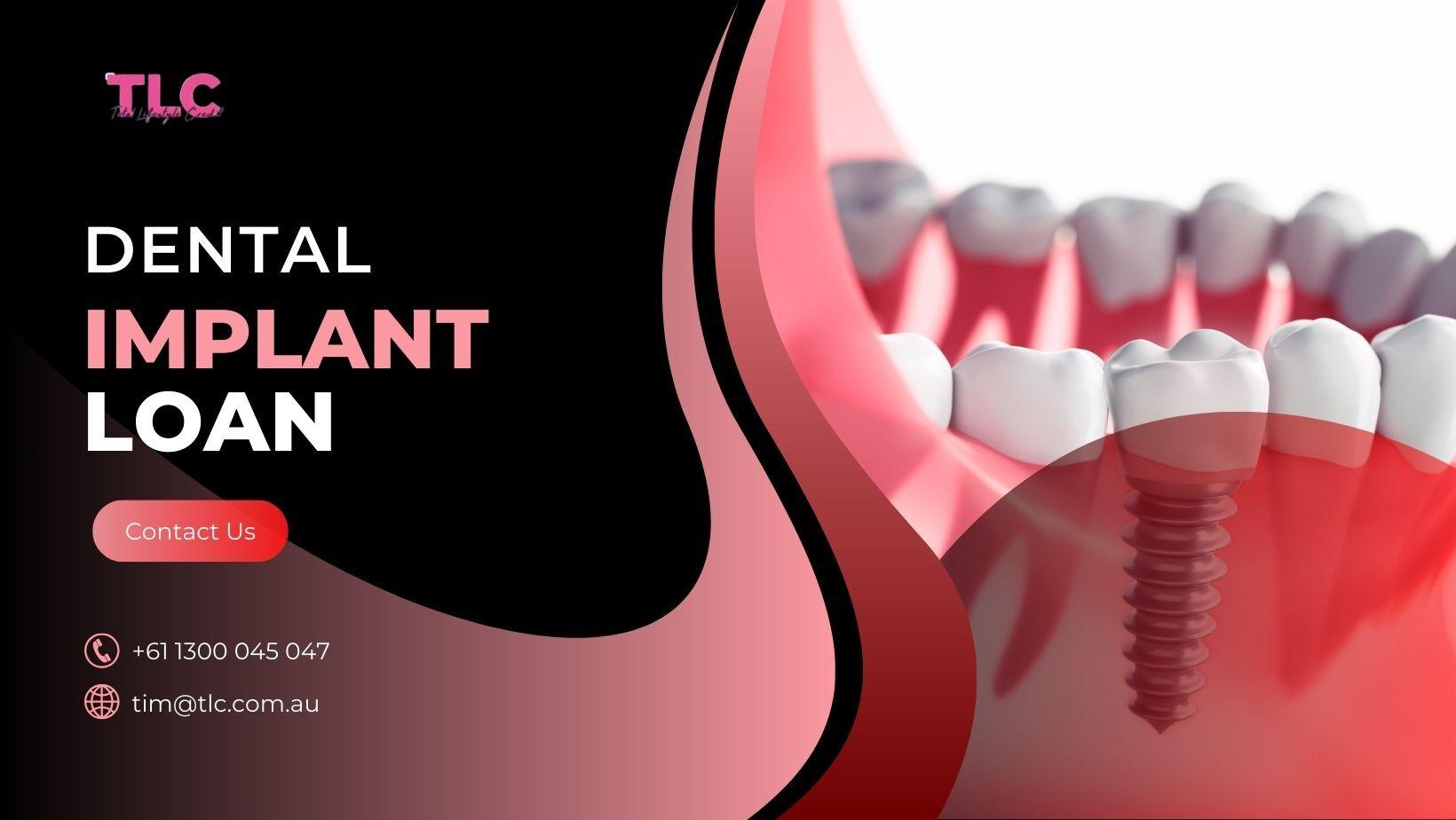 Getting a Dental Implant Loan Without Credit Worries