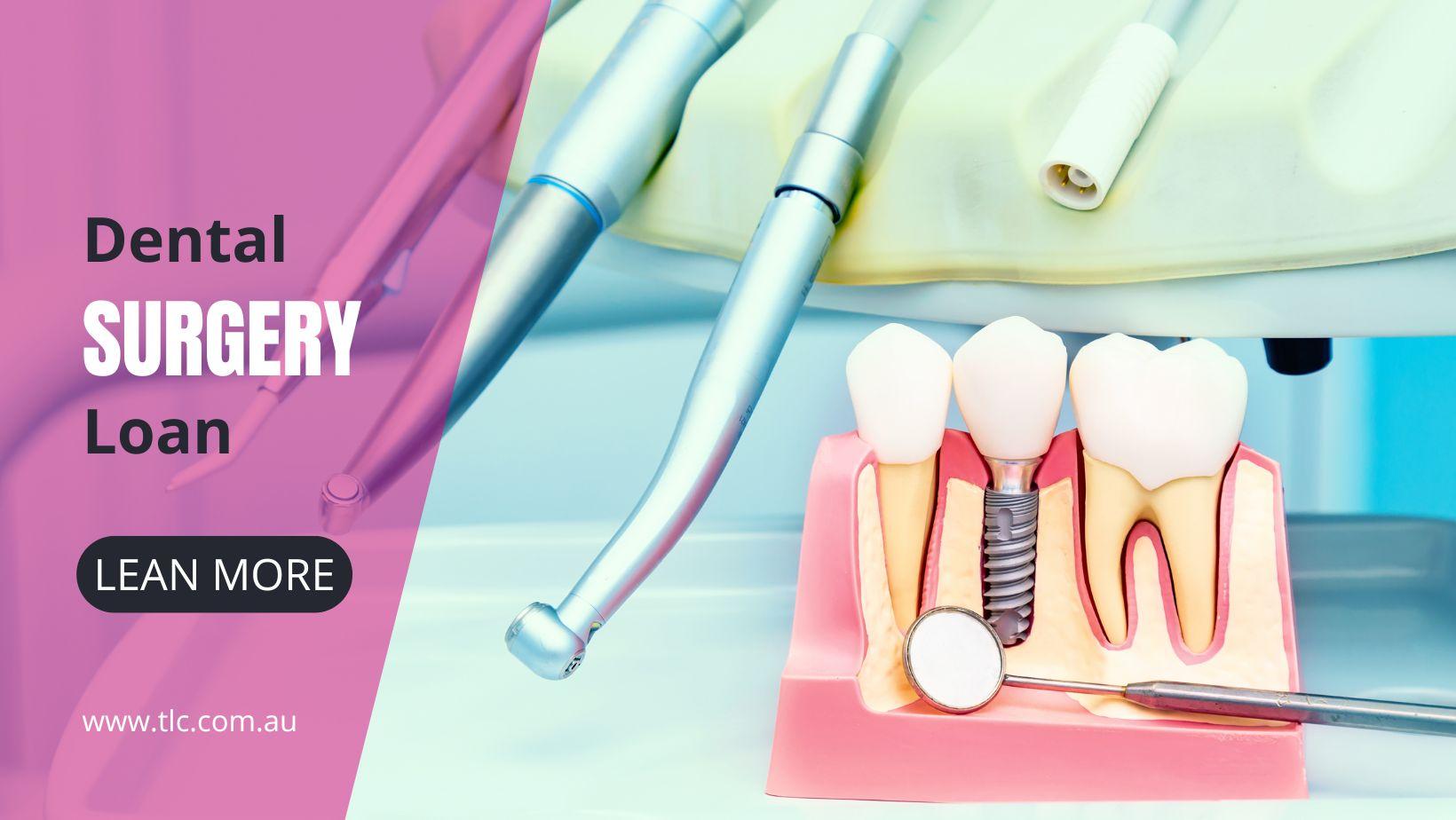 What to Know Before Taking a Dental Surgery Loan