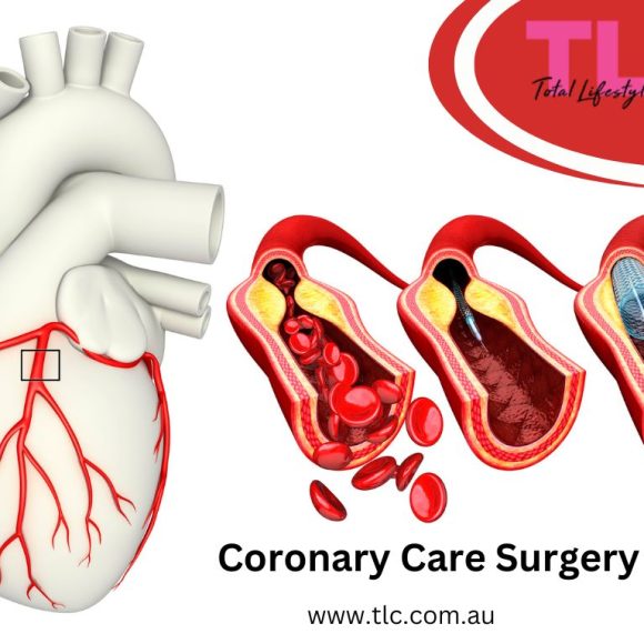 Coronary Care Surgery: Purpose, Procedure and Recovery