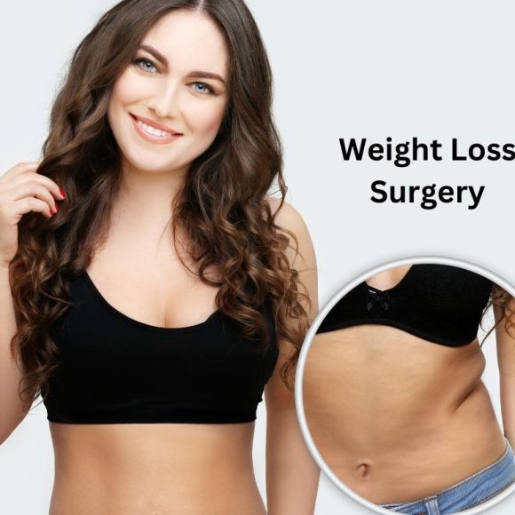How to Choose the Best Weight Loss Surgery Loan Provider
